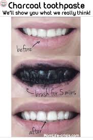 When applied to teeth, the black magic toothpaste acts like magner to draw out teeth stains. Pin On Skin Bleaching Products