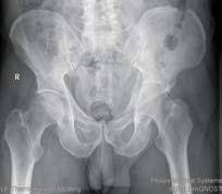 This makes it perfect for managing the pain and swelling that comes with tendonitis. Http Www Unfallchirurgen At Download Jatros Unfall 1203 Ansichts Pdf