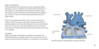 Cells | Free Full-Text | Inherited And Acquired Rhythm Disturbances In Sick  Sinus Syndrome, Brugada Syndrome, And Atrial Fibrillation: Lessons From  Preclinical Modeling