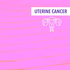The discomfort and constant cramping from the endometriosis never got significantly better. Treatment Of Stage Iii Uterine Cancer Cancerconnect