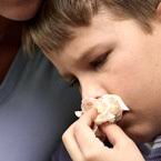 In most cases, nosebleeds are caused by minor trauma and stop bleeding within minutes, especially if ice is applied or the bridge of the nose is pinched. Chronic Nosebleeds What To Do Healthychildren Org