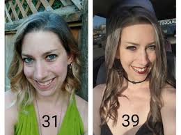 Impressive results with skin care product after two weeks