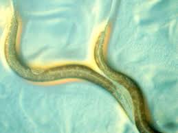 Der Wurm Und Sein Mensch Alle Fakten Zu Wurmern Und Parasiten Erkrankungen Gesundheit