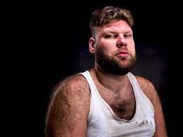 Hirsutism is excess hair growth on the body or face. Excessive Hair Growth In Men And Women Top Doctors Online