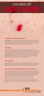 The spots may appear smooth and even with cherry angiomas are typically harmless and not a cause for concern. Cherry Angioma Characteristics Causes Treatment