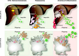 Hepcidin In Human Iron Disorders Therapeutic Implications Journal Of Hepatology