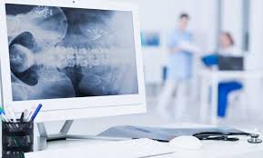 Was Sind Osteoporose Symptome
