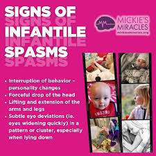 Image result for Infantile Spasms