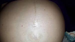 Welcome to another sunday vlog! Linea Nigra Black Line Or Linea Alba Pregnancy Youtube