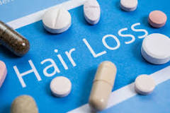 Hair Loss Tablets - Anti-Baldness Treatment in South Africa