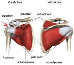 Tendinite calcifiante épaule, calcifications épaule, calcification épaule traitement, rupture de la coiffe des rotateurs : Les Blessures De L Epaule Au Tennis Syndrome De La Coiffe Des Rotateurs
