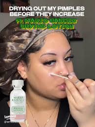 Mario Badescu Buffering Lotion vs Drying Lotion: Which Acne Treatment Works  Better?
