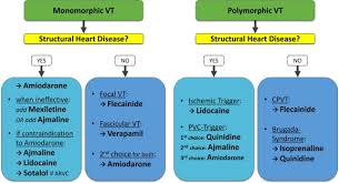 Image result for Ventricular Fibrillation Management in the Adult