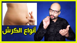 أنواع الكرش و كيف نتخلص منها للأبد Types Of Belly Fat Youtube
