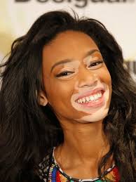 Krásna tvár nie je všetko: Modeling, ako ho zaručene nepoznáte