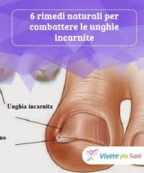 Unghia Incarnita Ecco 6 Rimedi Naturali Ideali Vivere Piu Sani Rimedi Naturali Rimedi Rimedi Per La Salute