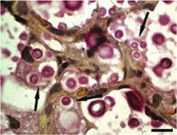 cshperspectmed-HFP-a019760 1..28