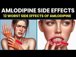 Diamond Valley, St Philip, Barbados. Roger Batson, 61.