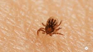 Most tick bites are painless and cause only minor signs and symptoms, such as redness, swelling or a sore on the skin. Video How A Tick Digs Its Hooks Into You And Then How Do You Get It Out Goats And Soda Npr