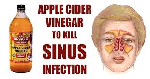 We did not find results for: Pin On Acv Healthy Tips