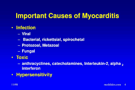 Treatment for myocarditis depends on the cause. Ppt Myocarditis Powerpoint Presentation Free Download Id 391008