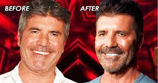 When simon cowell was only twelve years old, he was arrested because he hijacked a bus with a pea gun. Agt Fans Shook Is Simon Cowell S New Face Due To Vegan Diet Or Botox Talent Recap