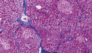 These endocrine glands secrete hormones directly into the bloodstream and consist of three main cell types (alpha, beta, and delta) which. Identify A Pancreatic Islet Islet Of Langerhans On Chegg Com