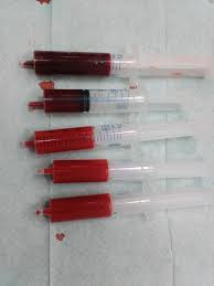 Plasma darah sebagian besar terdiri dari air yaitu 90% dan mengandung protein & bahan organik. Darah Wikipedia Bahasa Indonesia Ensiklopedia Bebas