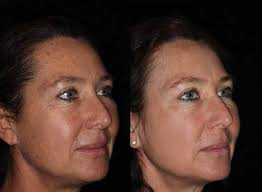 Clinical Casebook M22™ Treatments