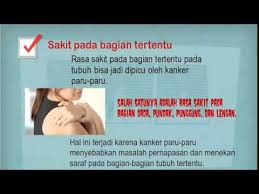 Bakteri dapat melakukan perjalanan melalui udara dan menyebar dari satu orang ke orang berikutnya. 7 Gejala Awal Kanker Paru Paru Yang Tak Disadari Youtube