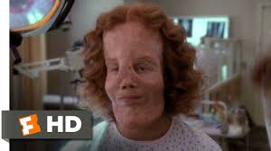 Rocky Dennis: The True Story Of The Boy Who Inspired 'Mask'