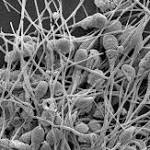  Male Contraceptive Stops Sperm From Swimming, Doesn't Have Hormonal Side Effects