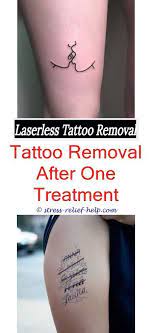 Wie Viele Sitzungen Dauert Es Um Ein Tattoo Zu Entfernen Tattoos Dauert Diypermanent Tattoo Removal Cost Think Tattoo Diy Tattoo Permanent