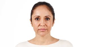 Your medical practitioner will give you all the advice you need and may recommend a regular maintenance treatment every six months, depending on the condition of your skin. Juvederm Vs Restylane Comparing The Dermal Fillers