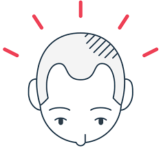 And still others choose one of the treatments available to prevent further hair loss or restore growth. Hair Loss Treatment Propecia Finasteride