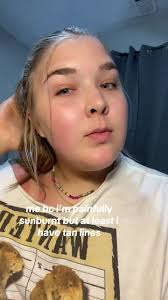 Larry the Lobster's Sunburn Experience