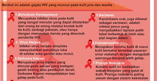 Penyebab hiv adalah infeksi virus yang menyerang dan menghancurkan sel cd4 dalam tubuh. Rsup Dr Sardjito Mengenal Infeksi Menular Seksual Dan Manifestasi Klinis Aids Pada Kulit