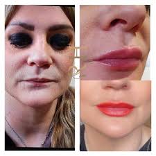 We Used Makeup To Show Smokers What They Could Look Like In The Future