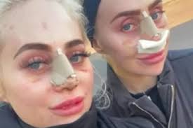 Gêmeas gastam R$ 1 milhão em cirurgias plásticas para ficarem idênticas