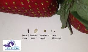 Comparison Chart Showing Lice Nits And Their Size Compared To Sesame And Strawberry Seed Lice Removal Lice Nits Louse