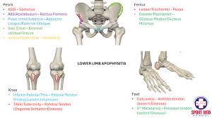 Image result for Hip Apophysitis