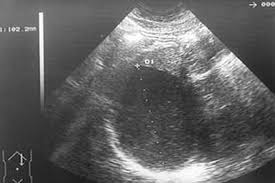 In a way it is true. Anatomia Del Bazo