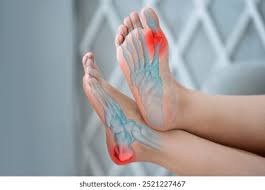 Image result for Hallux Varus