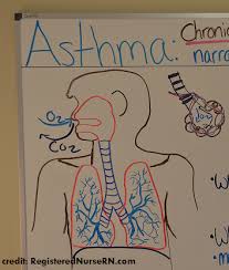 About this quiz those of us who are healthy often take the ability to breathe for granted. Asthma Nclex Review