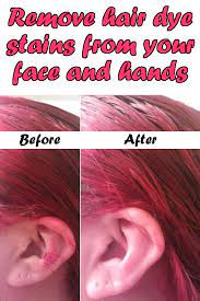 Get more information about this question how to get dye off of skin and find other details on it. Useful Ideas On How To Remove Hair Dye From Skin Alldaychic