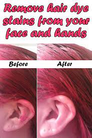 Any kind of oil — such as coconut oil, baby oil, or argan oil — can also work as a cleanser to remove hair dye. Useful Ideas On How To Remove Hair Dye From Skin Alldaychic