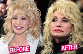You may have heard jolene, but did you know that dolly parton turned down a chance to work with elvis presley? Poisoned By Botox Top Doc Says Dolly Has Gone Too Far