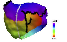 Digitale Simulation Der Organe
