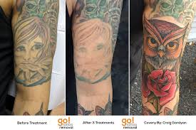 After getting the tattoo, it looks the direct opposite of what you want it to be. Tattoo Removal To Tattoo Cover Up Go Tattoo Removal