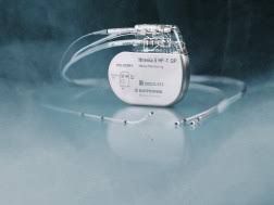 Beim defibrillieren zählt jede sekunde. Was Ist Ein Icd Defi Selbsthilfezirkel Kaiserlautern Selbsthilfegruppe Fur Patienten Mit Implantiertem Defibrillator